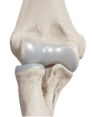 anatomia-cotovelo-osso